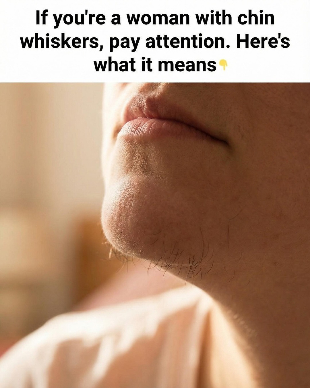 Chin Hair in Women: Why It Happens and How to Manage It Confidently